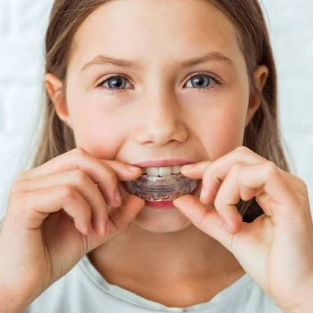 Young child fitting a clear Myobrace trainer over their teeth