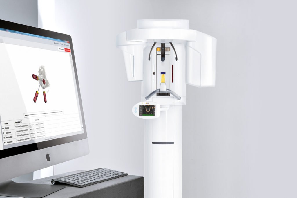 3d-endo-1024x682.jpg